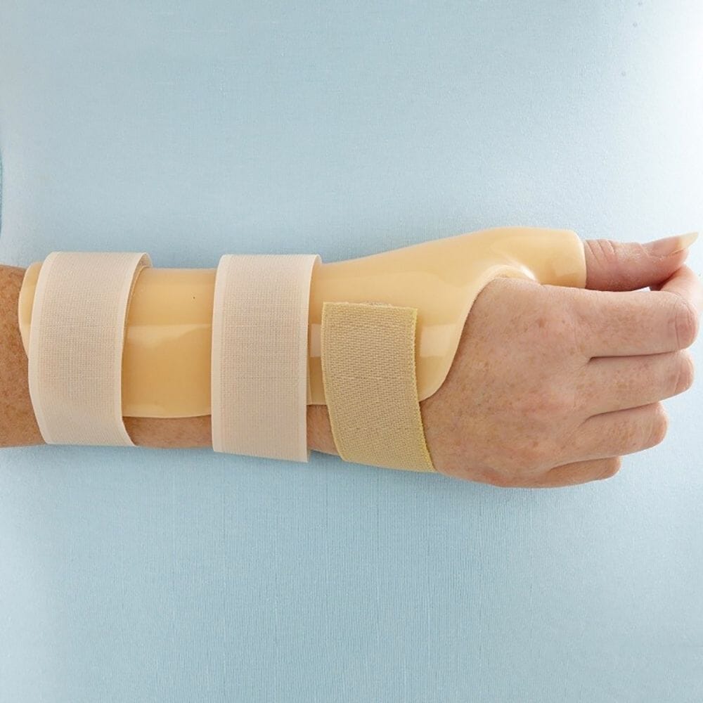 Extended Thumb Spica/Splint