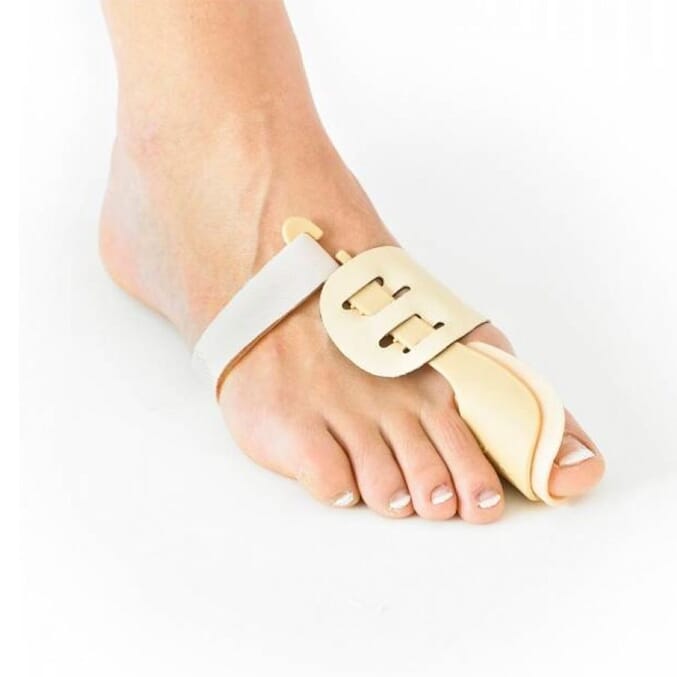 neo g the hallux valgus _bunion_