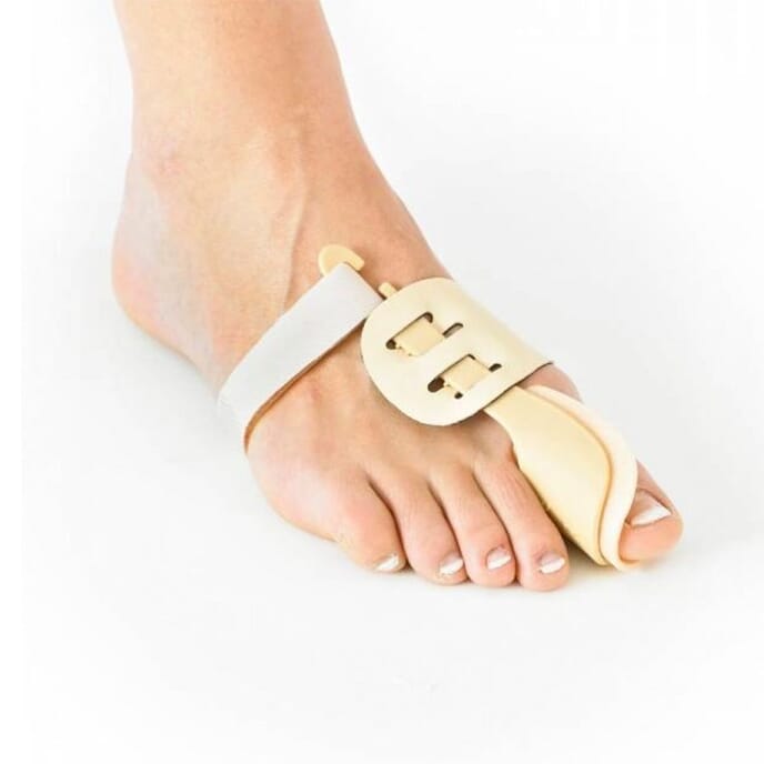 neo g the hallux valgus _bunion_